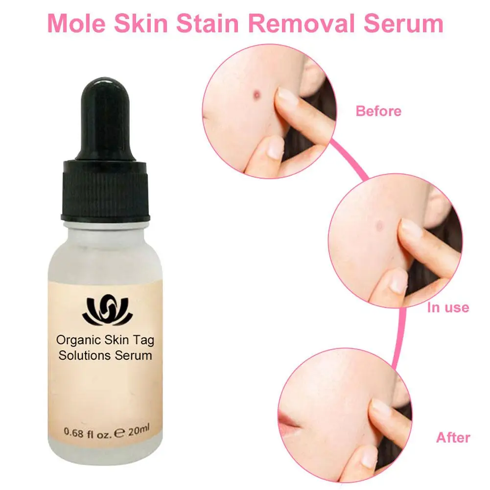 Face Serum Whitening Skin Care Freckle Removal Acne Scar - Image 4