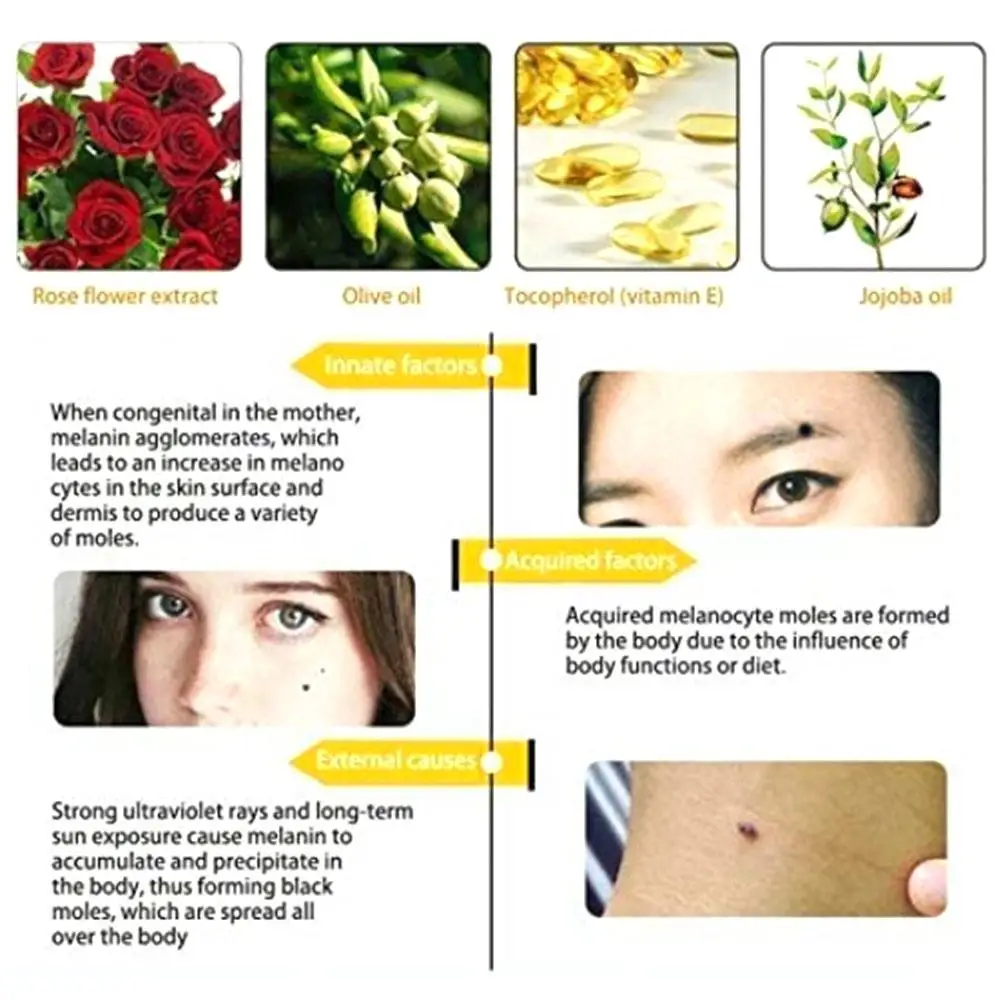 Face Serum Whitening Skin Care Freckle Removal Acne Scar - Image 2